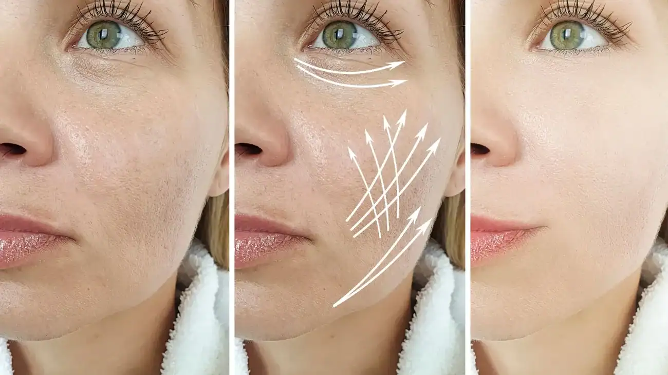 Can One Treatment Really Tackle More Than One Skin Concern Ilford?