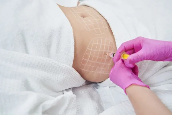 image of fat dissolving injections on love handles to help combat weight gain Ilford