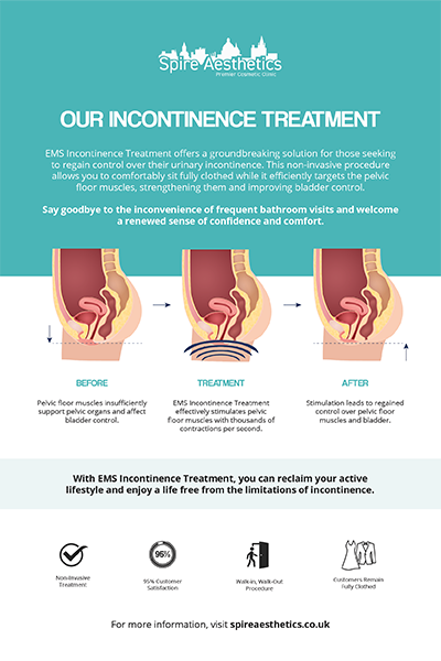 image of how urge incontinence Ilford treatment works