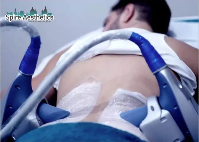 Man having fat freezing treatment done on love handles before a competitions Ilford to create a sculpted look.