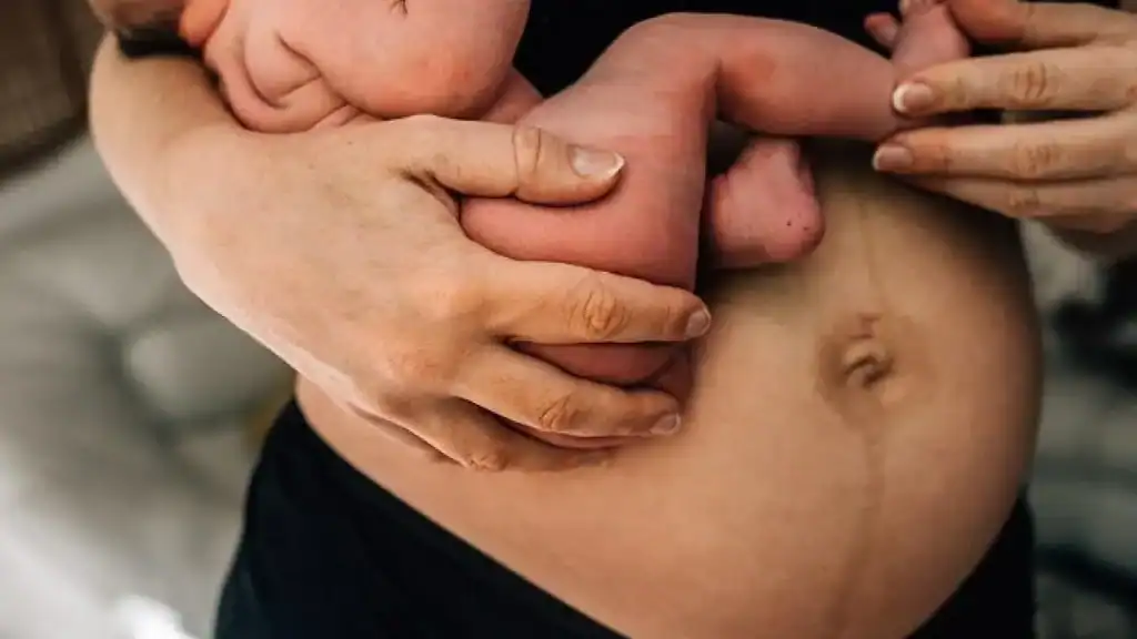 Why Is My Stomach Still Big After Pregnancy Ilford?